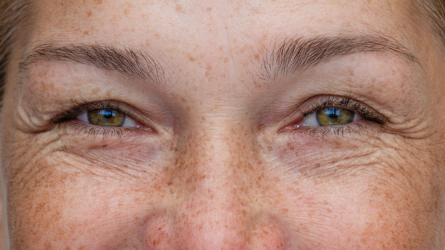 Your Guide to Wrinkles: Understanding Their Causes and How to Prevent Them
